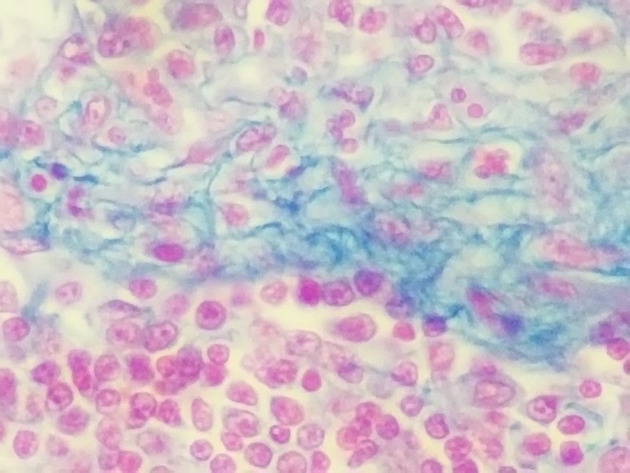 Reticular Connective Slides - Reticular Connective 04 400X